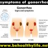 Things you should know about GONORRHEA.