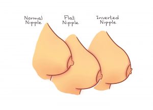 Long Nipples On Women